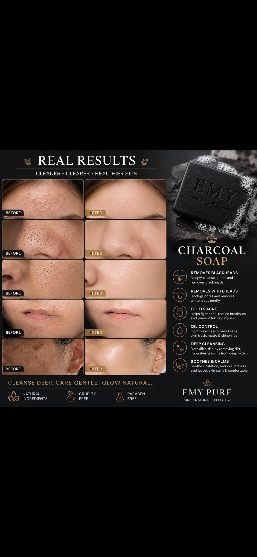 Charcoal soap( Activated Charcoal + Tea Tree Oil + Salicylic Acid)